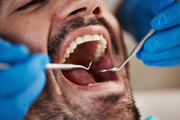 Best Emergency Denture Repair in Leawood, KS