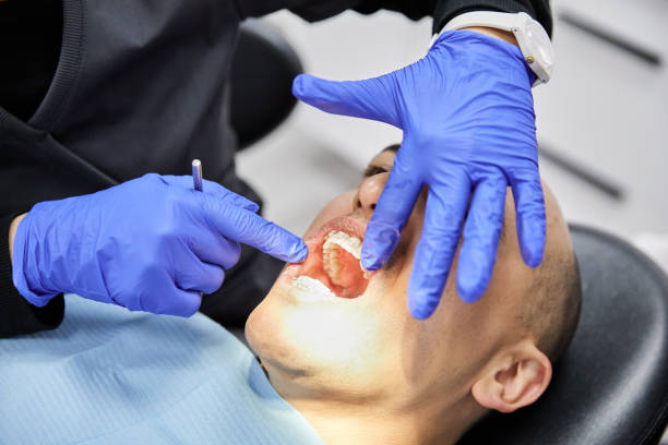 Best Emergency Wisdom Teeth Removal in Leawood, KS